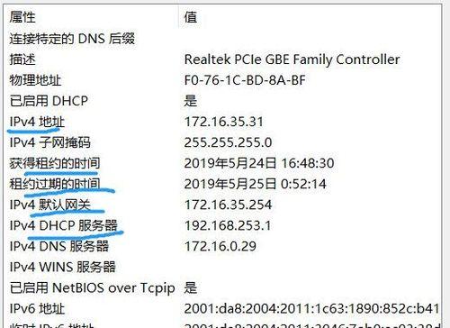 电脑没有ip配置怎么办？如何快速解决ip配置问题？