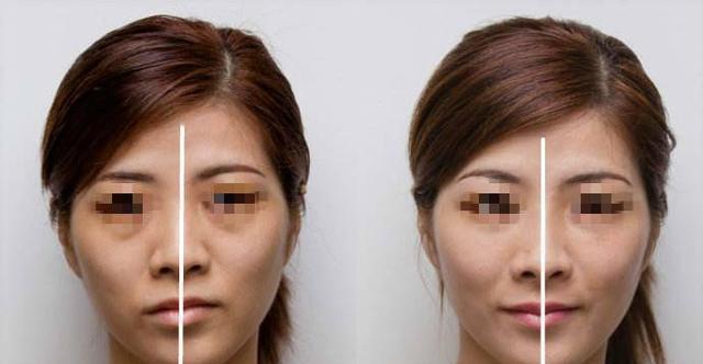 手机拍照时如何调整避免脸部歪斜？有哪些技巧？
