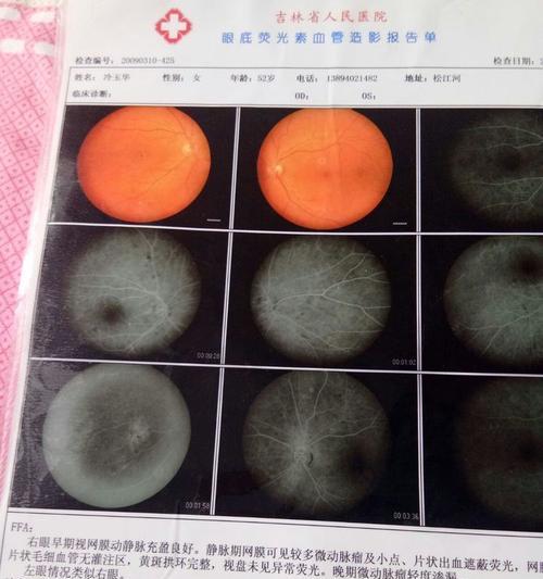 苹果手机网膜的功能和作用是什么？